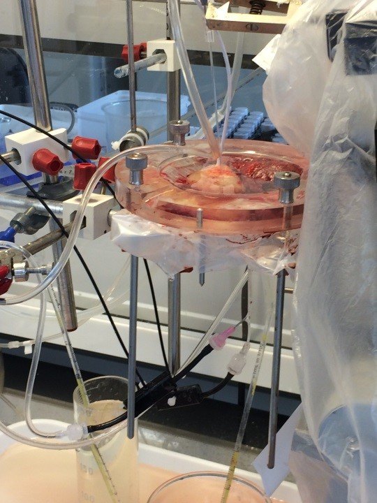 Photo of perfusion technique